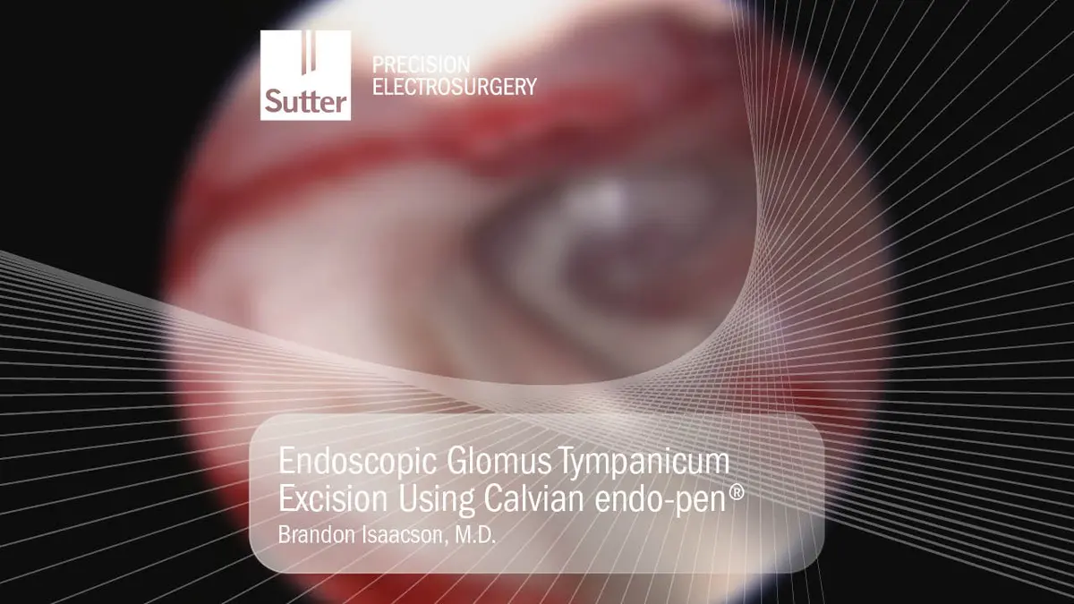 Blurred Endoscopic view of glomus tympanicum excision using Calvian endo-pen® by Brandon Isaacson, M.D.