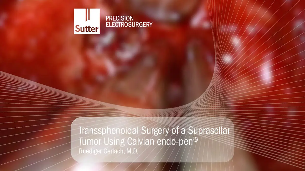 Transsphenoidal surgery of a suprasellar tumor using the Calvian endo-pen® by Dr. Ruediger Gerlach, shown during a neurosurgical procedure with precision electrosurgery instruments.