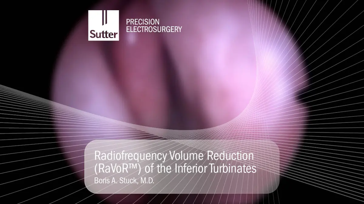 Blurred Radiofrequency volume reduction (RaVoR™) of the inferior turbinates performed by Boris A. Stuck, M.D.