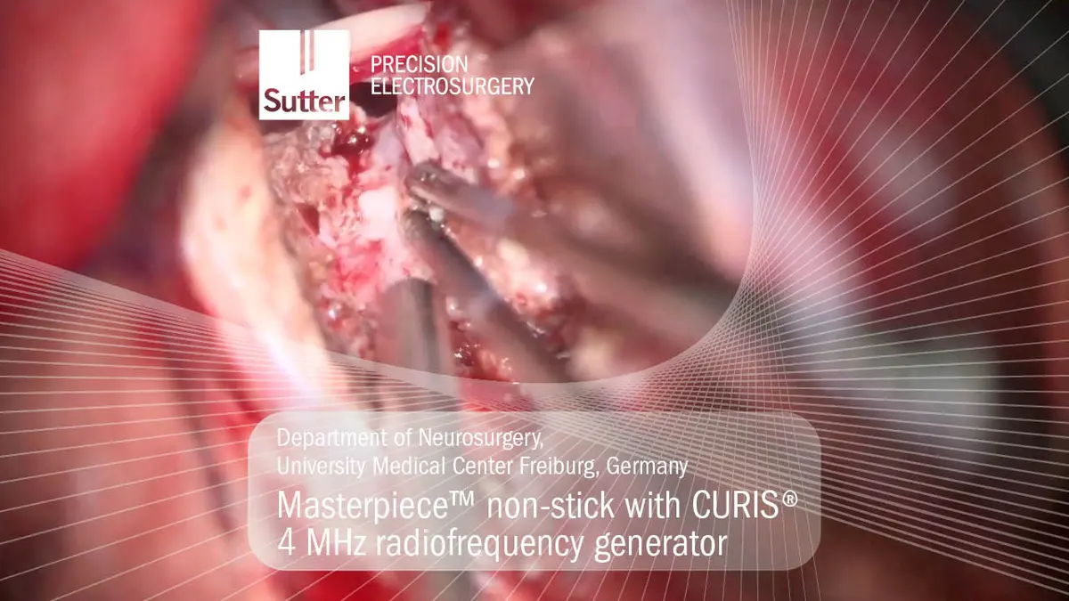 Neurosurgical procedure using Masterpiece™ non-stick bipolar forceps with CURIS® 4 MHz radiofrequency generator at University Medical Center Freiburg, Germany