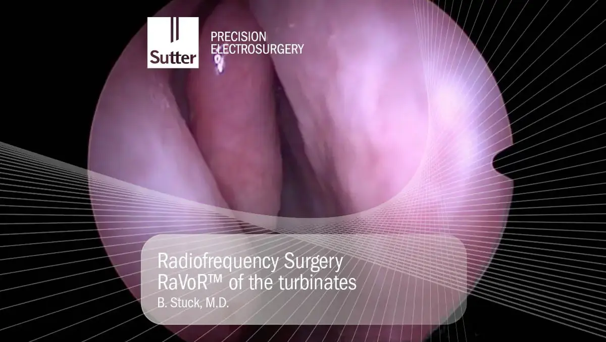 Endoskopisches Bild einer Radiofrequenz-Anwendung an den Nasenmuscheln